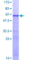 ZNF509 / ZBTB49 Protein - 12.5% SDS-PAGE of human ZNF509 stained with Coomassie Blue