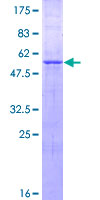 ZNF511 Protein - 12.5% SDS-PAGE of human ZNF511 stained with Coomassie Blue