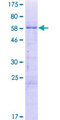 ZNF524 Protein - 12.5% SDS-PAGE of human ZNF524 stained with Coomassie Blue