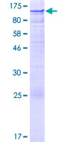 ZNF526 Protein - 12.5% SDS-PAGE of human ZNF526 stained with Coomassie Blue