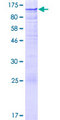ZNF526 Protein - 12.5% SDS-PAGE of human ZNF526 stained with Coomassie Blue