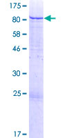 ZNF528 Protein - 12.5% SDS-PAGE of human ZNF528 stained with Coomassie Blue