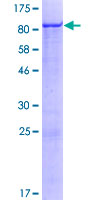 ZNF543 Protein - 12.5% SDS-PAGE of human ZNF543 stained with Coomassie Blue