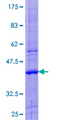 ZNF544 Protein - 12.5% SDS-PAGE of human ZNF544 stained with Coomassie Blue