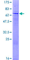ZNF547 Protein - 12.5% SDS-PAGE of human ZNF547 stained with Coomassie Blue
