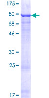 ZNF548 Protein - 12.5% SDS-PAGE of human ZNF548 stained with Coomassie Blue