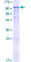 ZNF549 Protein - 12.5% SDS-PAGE of human ZNF549 stained with Coomassie Blue