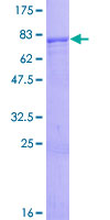 ZNF554 Protein - 12.5% SDS-PAGE of human ZNF554 stained with Coomassie Blue