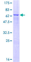 ZNF557 Protein - 12.5% SDS-PAGE of human ZNF557 stained with Coomassie Blue