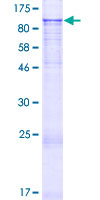 ZNF560 Protein - 12.5% SDS-PAGE of human ZNF560 stained with Coomassie Blue
