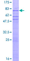 ZNF563 Protein - 12.5% SDS-PAGE of human ZNF563 stained with Coomassie Blue