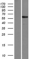 ZNF565 Protein - Western validation with an anti-DDK antibody * L: Control HEK293 lysate R: Over-expression lysate