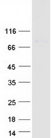 ZNF567 Protein - Purified recombinant protein ZNF567 was analyzed by SDS-PAGE gel and Coomassie Blue Staining