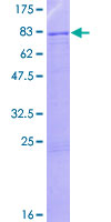 ZNF57 Protein - 12.5% SDS-PAGE of human ZNF57 stained with Coomassie Blue