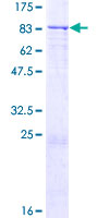 ZNF571 Protein - 12.5% SDS-PAGE of human ZNF571 stained with Coomassie Blue