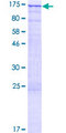 ZNF574 Protein - 12.5% SDS-PAGE of human ZNF574 stained with Coomassie Blue