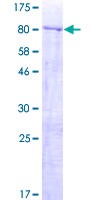 ZNF577 Protein - 12.5% SDS-PAGE of human ZNF577 stained with Coomassie Blue