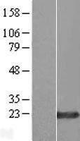 ZNF580 Protein - Western validation with an anti-DDK antibody * L: Control HEK293 lysate R: Over-expression lysate