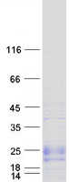 ZNF581 Protein - Purified recombinant protein ZNF581 was analyzed by SDS-PAGE gel and Coomassie Blue Staining