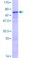 ZNF584 Protein - 12.5% SDS-PAGE of human ZNF584 stained with Coomassie Blue