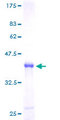 ZNF593 Protein - 12.5% SDS-PAGE of human ZNF593 stained with Coomassie Blue