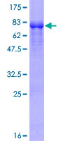 ZNF597 Protein - 12.5% SDS-PAGE of human ZNF597 stained with Coomassie Blue