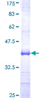 ZNF598 Protein - 12.5% SDS-PAGE Stained with Coomassie Blue.