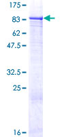 ZNF599 Protein - 12.5% SDS-PAGE of human ZNF599 stained with Coomassie Blue