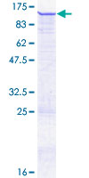 ZNF606 Protein - 12.5% SDS-PAGE of human ZNF606 stained with Coomassie Blue