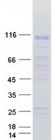 ZNF606 Protein - Purified recombinant protein ZNF606 was analyzed by SDS-PAGE gel and Coomassie Blue Staining