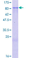 ZNF613 Protein - 12.5% SDS-PAGE of human ZNF613 stained with Coomassie Blue