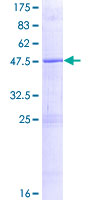 ZNF614 Protein - 12.5% SDS-PAGE of human ZNF614 stained with Coomassie Blue