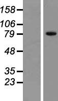 ZNF615 Protein - Western validation with an anti-DDK antibody * L: Control HEK293 lysate R: Over-expression lysate