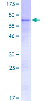 ZNF620 Protein - 12.5% SDS-PAGE of human ZNF620 stained with Coomassie Blue