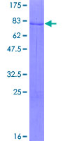 ZNF621 Protein - 12.5% SDS-PAGE of human ZNF621 stained with Coomassie Blue