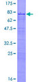 ZNF622 Protein - 12.5% SDS-PAGE of human ZNF622 stained with Coomassie Blue