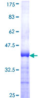ZNF622 Protein - 12.5% SDS-PAGE Stained with Coomassie Blue.