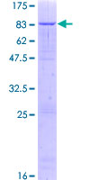 ZNF623 Protein - 12.5% SDS-PAGE of human ZNF623 stained with Coomassie Blue