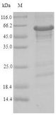 ZNF638 Protein - (Tris-Glycine gel) Discontinuous SDS-PAGE (reduced) with 5% enrichment gel and 15% separation gel.