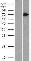 ZNF639 Protein - Western validation with an anti-DDK antibody * L: Control HEK293 lysate R: Over-expression lysate