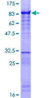ZNF639 Protein - 12.5% SDS-PAGE of human ZNF639 stained with Coomassie Blue