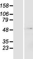 ZNF643 Protein - Western validation with an anti-DDK antibody * L: Control HEK293 lysate R: Over-expression lysate
