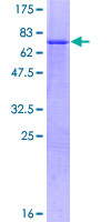 ZNF643 Protein - 12.5% SDS-PAGE of human ZNF643 stained with Coomassie Blue
