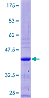 ZNF644 Protein - 12.5% SDS-PAGE of human ZNF644 stained with Coomassie Blue