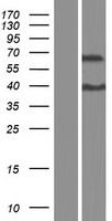 ZNF648 Protein - Western validation with an anti-DDK antibody * L: Control HEK293 lysate R: Over-expression lysate