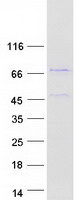 ZNF648 Protein - Purified recombinant protein ZNF648 was analyzed by SDS-PAGE gel and Coomassie Blue Staining