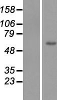 ZNF649 Protein - Western validation with an anti-DDK antibody * L: Control HEK293 lysate R: Over-expression lysate