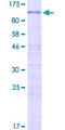ZNF653 Protein - 12.5% SDS-PAGE of human ZNF653 stained with Coomassie Blue