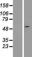ZNF654 Protein - Western validation with an anti-DDK antibody * L: Control HEK293 lysate R: Over-expression lysate
