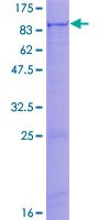 ZNF658 Protein - 12.5% SDS-PAGE of human ZNF658 stained with Coomassie Blue
